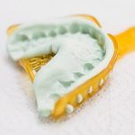 molde de dientes para ortodoncia