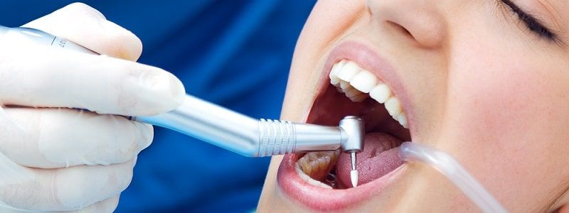Las 5 mayores ventajas de la ortodoncia dental en adultos