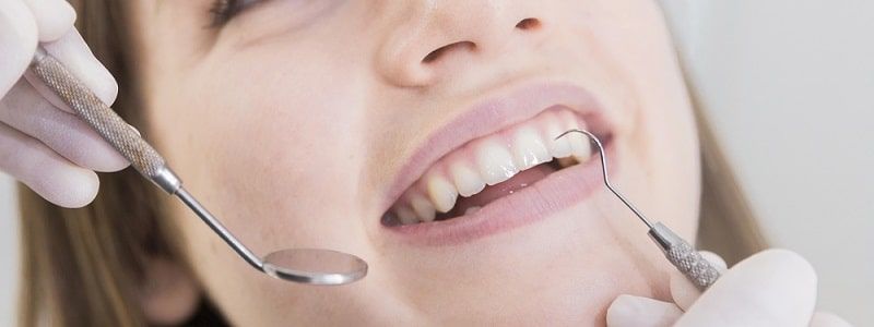 Revisión bucal preventiva - Clínica Dental Manosalbas