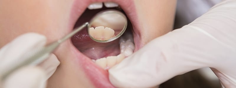 ¿A qué edad se tendría que empezar con la ortodoncia?