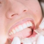 Dudas sobre ortodoncia invisible | Clínica Dental Manosalbas