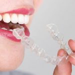 Ortodoncia Invisalign | Clínica Dental Manosalbas