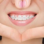 ¿Es posible tratar con Invisalign todos los casos de ortodoncia?