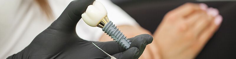 clinica de implantes dentales