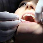 Beneficios de la limpieza dental durante tratamientos de ortodoncia